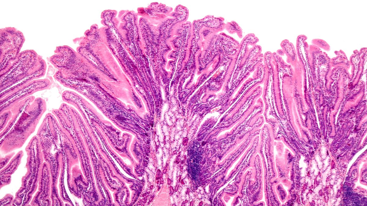 Leaky Gut: Wissenschaftliche Erkenntnisse & effektive Maßnahmen zur Regeneration Deines Darms