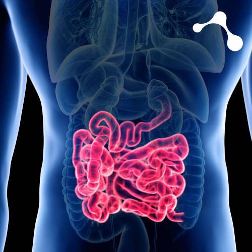 Dickdarm Mann Leaky Gut