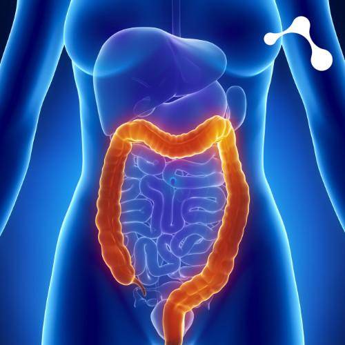 Dünndarm Frau Leaky Gut
