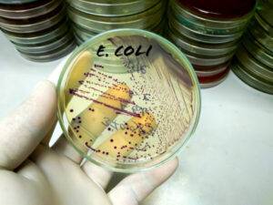 E. Coli und Dysbiose