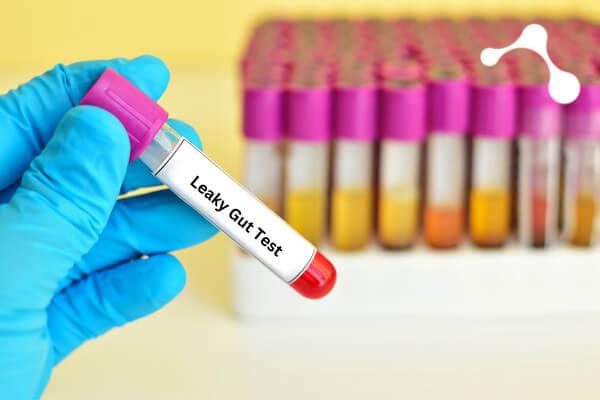 Leaky Gut Testmöglichkeiten