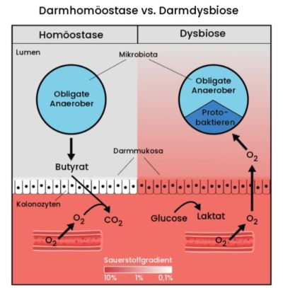 Darmhomöostase vs. Darmdysbiose Grafik